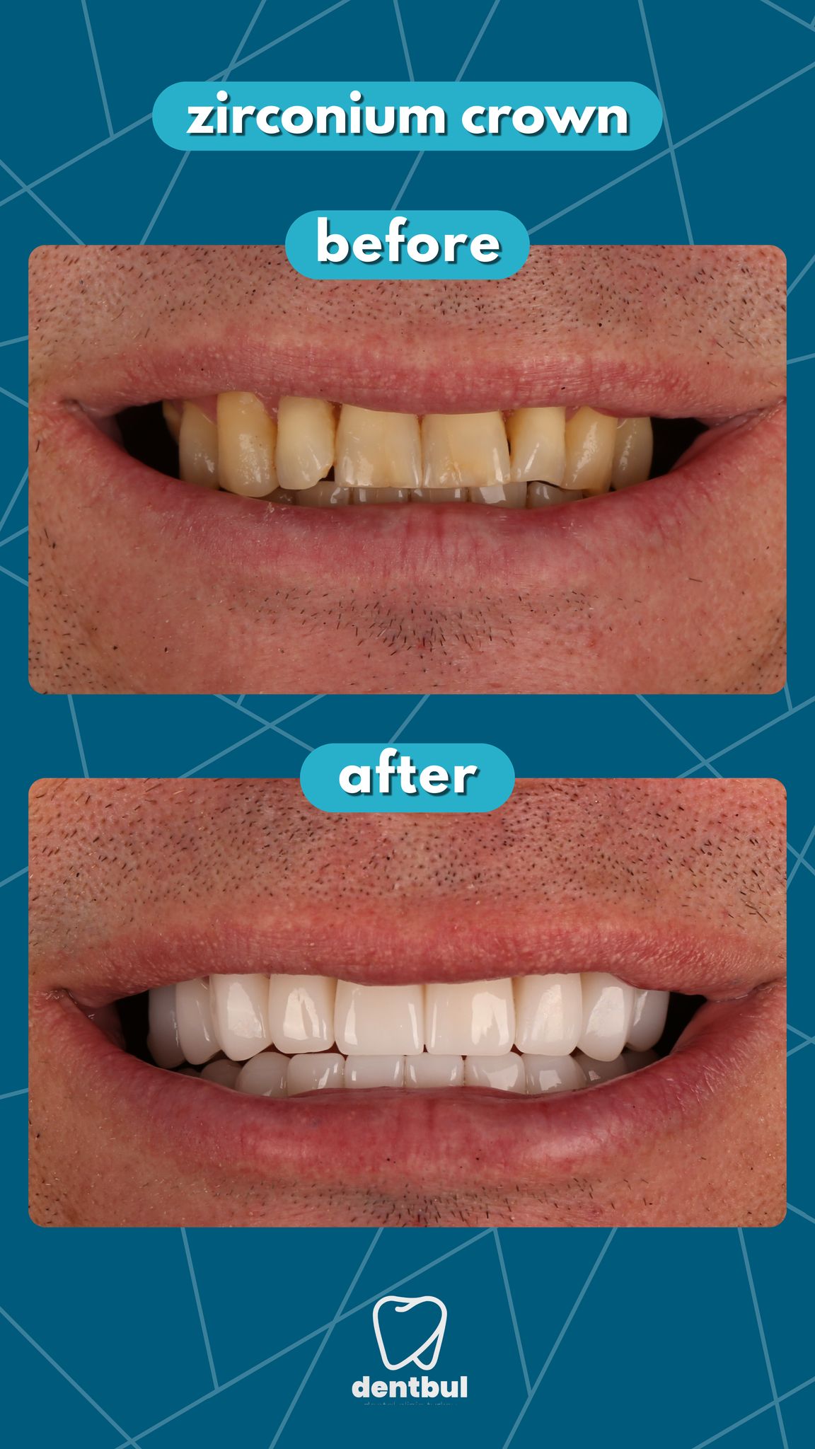Dental Treatment Result