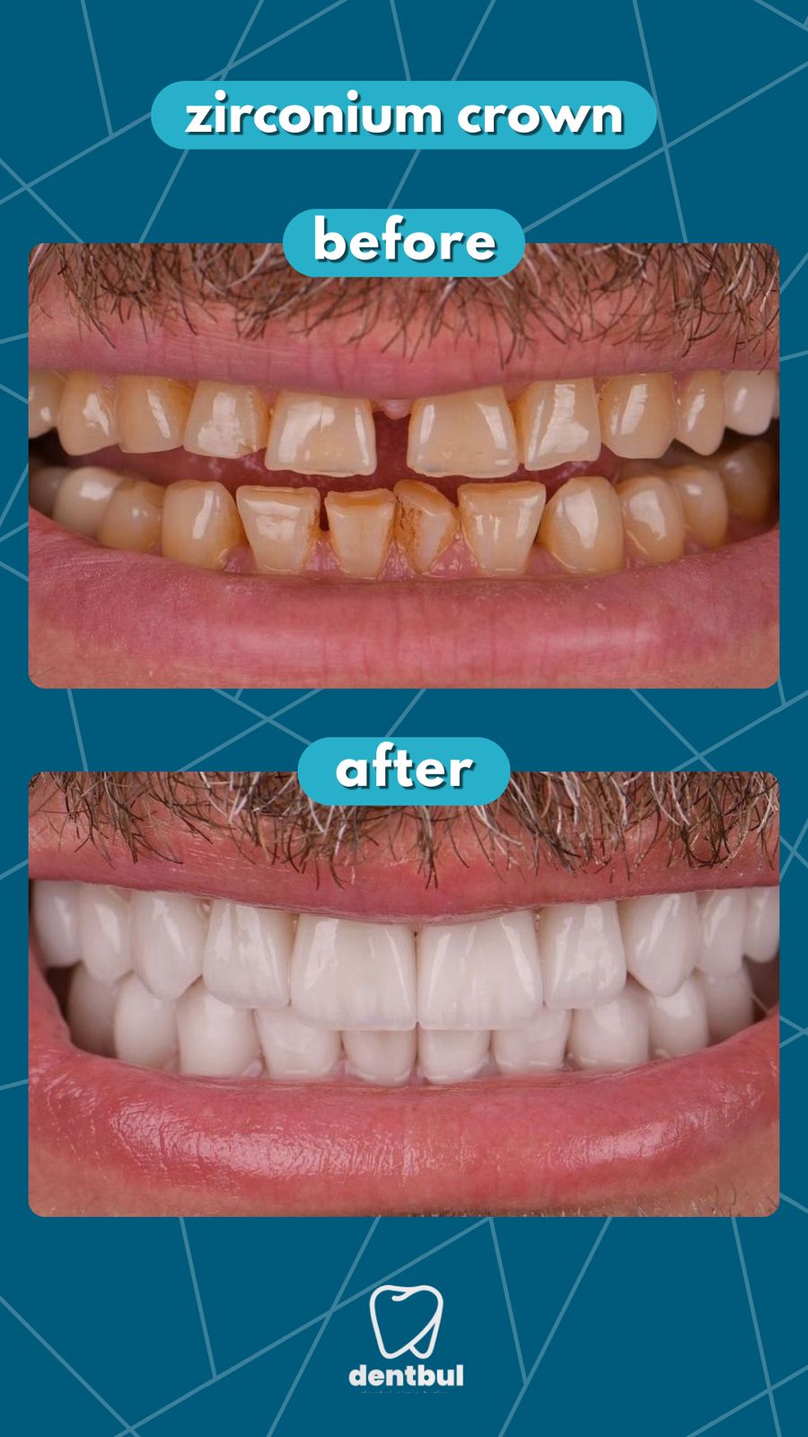 Dental Treatment Result