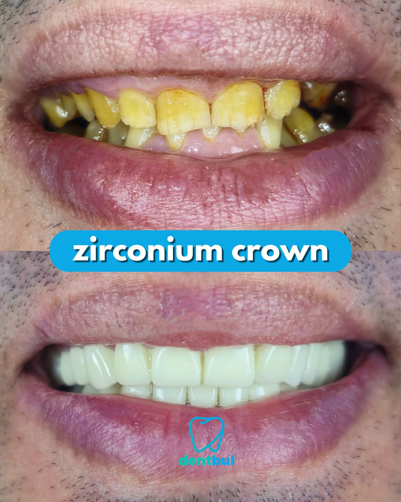 Dental Treatment Result