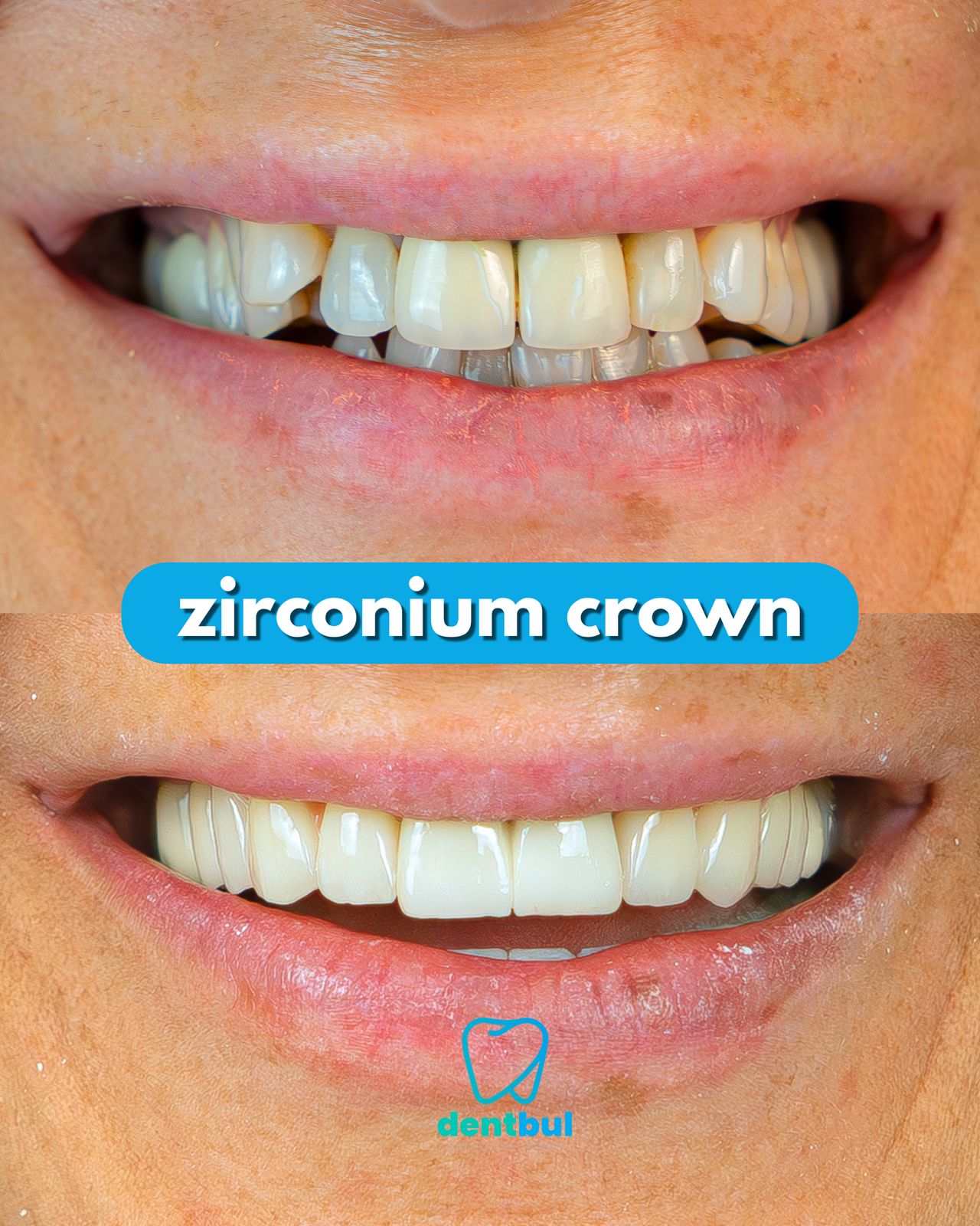 Dental Treatment Result