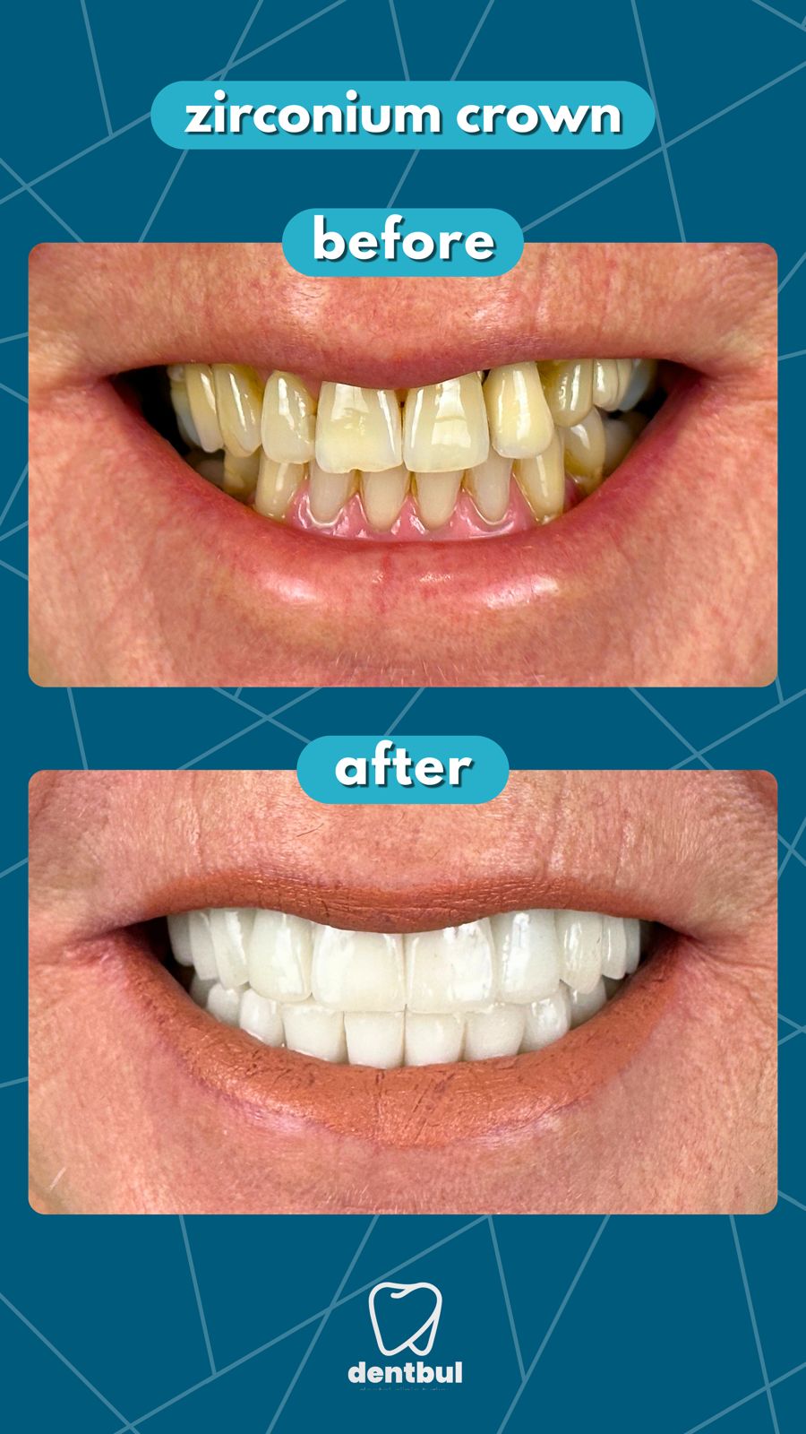 Dental Treatment Result